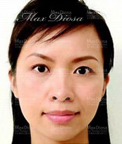 個案1:Karen 治療後 個案1:Karen 治療後