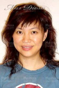 個案4:Mrs Lau 個案4:Mrs Lau