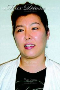 個案9:Jenny 個案9:Jenny